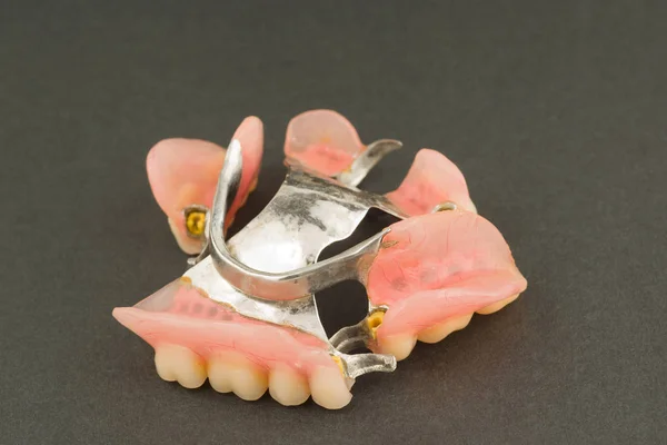 Εικόνα Του Μια Σύγχρονη Τόξου Οδοντοστοιχία Συνημμένο Μαύρο Φόντο — Φωτογραφία Αρχείου