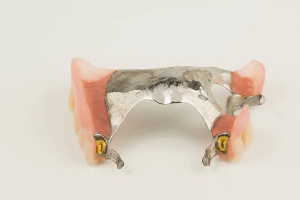 Bugel usunąć protezy z załącznikami — Zdjęcie stockowe