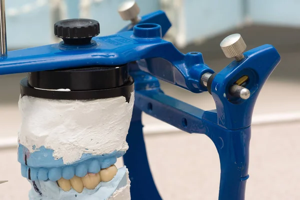 Articulador dental com modelos dentários rebocados — Fotografia de Stock