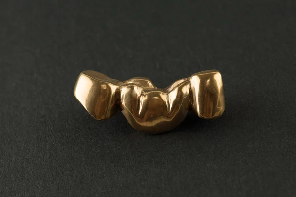 Künstliche Zahnkrone aus Stahl für Zahnersatz — Stockfoto