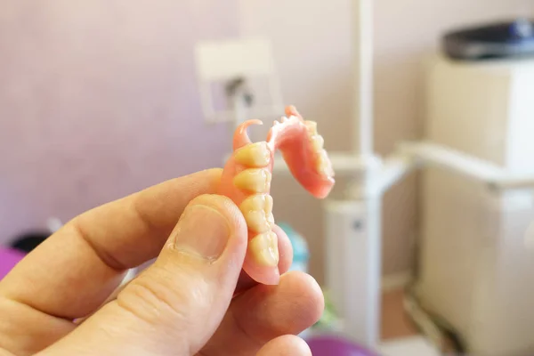 Prothèse dentaire amovible entre les mains d'un médecin — Photo