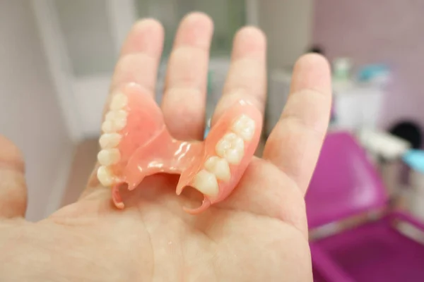 Dentadura removível nas mãos de um médico — Fotografia de Stock