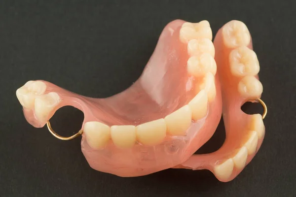 Prótesis Dental Acrílica Con Elementos Retención Metal Sobre Fondo Negro —  Fotos de Stock