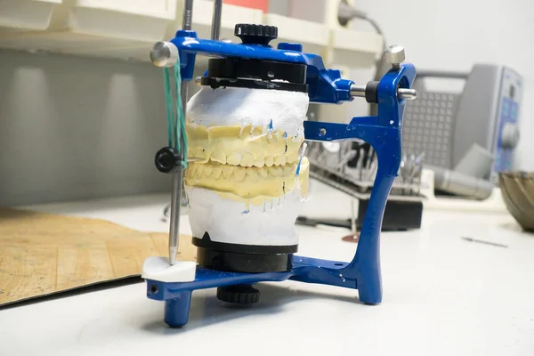 Workplace Dental Technician Plaster Models Articulator — Stock Photo, Image