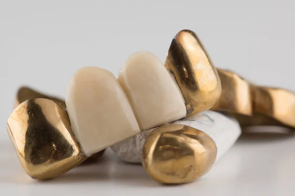 Puentes Dentales Soldados Estampados Recubiertos Oro Sobre Fondo Blanco — Foto de Stock