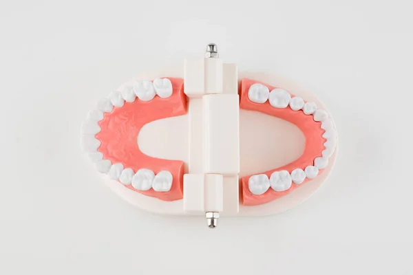 Acrylic Human Jaw Model Studying Oral Hygiene — Stock Photo, Image