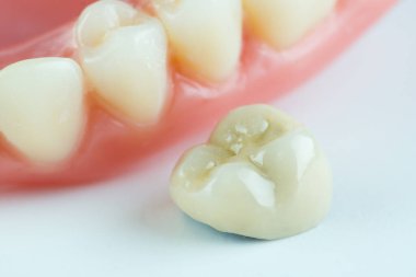 Beyaz arka planda modern takma dişin büyük resmi.