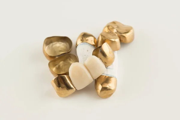 Beyaz arka planda altın kaplamalı, pullu diş köprüleri.