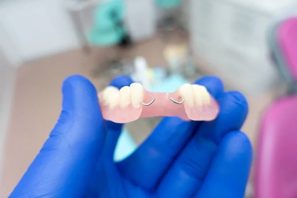 Prothèse Dentaire Amovible Dans Les Mains Médecin Gants Bleus — Photo
