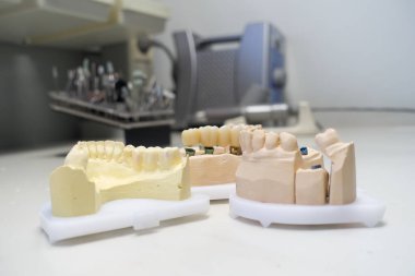 zirkon dişçi kaplamaları diş laboratuarında dişçi modelleri üzerinde