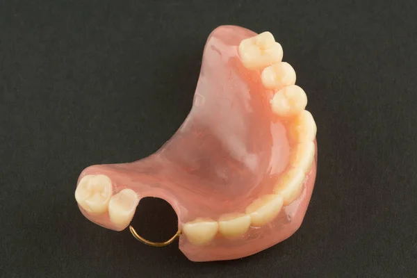 Prótese Dentária Acrílica Com Elementos Retenção Metal Sobre Fundo Preto — Fotografia de Stock