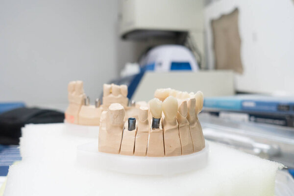 workplace of a dental technician for the manufacture of dental prostheses on implant