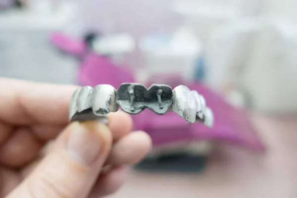 Metalowy Mostek Dentystyczny Procesie Produkcyjnym — Zdjęcie stockowe