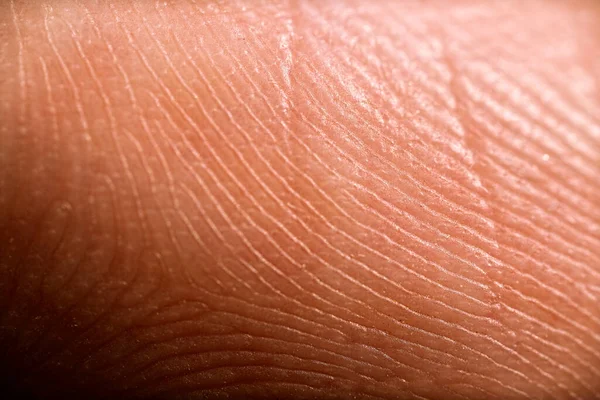 Detaillierte Makroaufnahme Menschlicher Haut Detaillierte Textur Hintergrund Der Nahaufnahme — Stockfoto