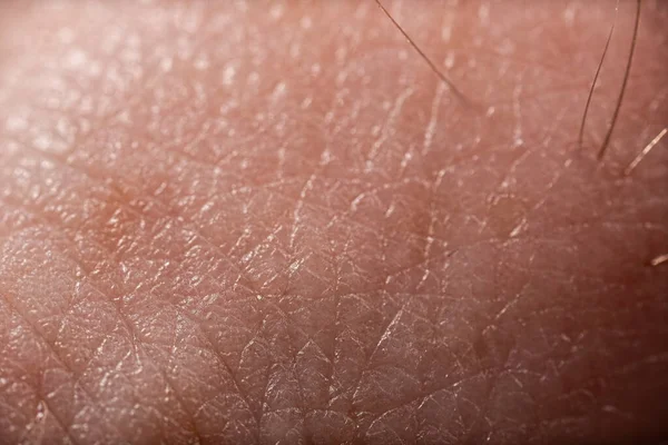 Detailed Macro Photo Human Skin Detailed Texture Closeup Background — Stock Photo, Image