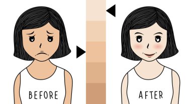 vektör kadın yüzü. Akne önce ve sonra. Cilt Bakımı illüstrasyon.