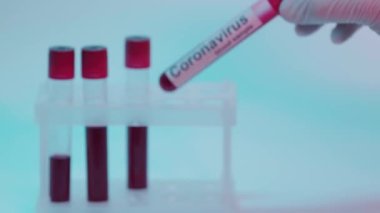 Üzerinde mavi harfler olan test tüpü tutan kişinin raf odağı.