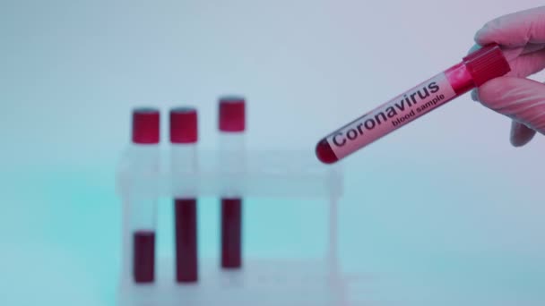 Cropped View Scientist Holding Test Tube Blood Sample Lettering Blue — Stock Video