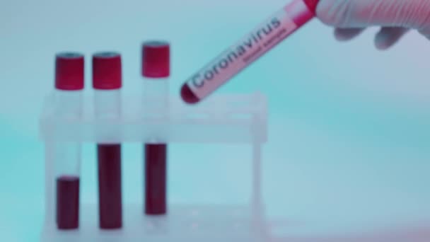 Rack Focus Person Holding Test Tube Blood Sample Lettering Blue — Stock Video