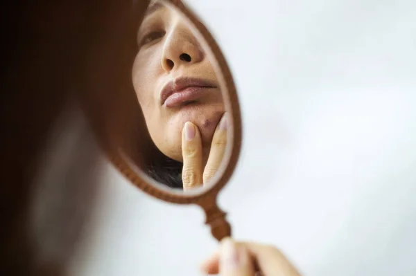 Menina Segura Pequeno Espelho Frente Dela Examina Pele Seu Rosto — Fotografia de Stock