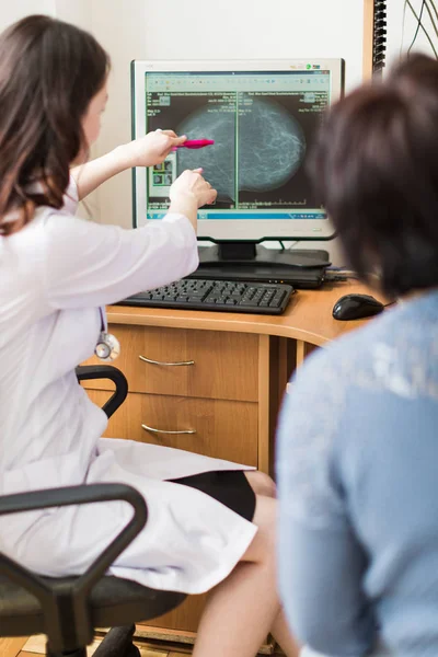 Jovem Especialista Mama Mostrando Exame Ultra Som Monitor Para Paciente — Fotografia de Stock