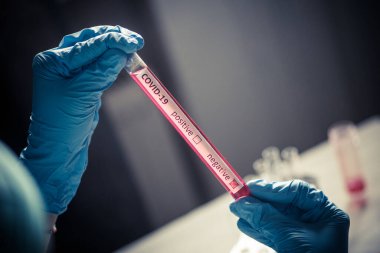 Coronavirus (COVID-19) için negatif örnekler içeren bir test tüpünü tutan ve gören bir doktorun kavramsal fotoğrafı).
