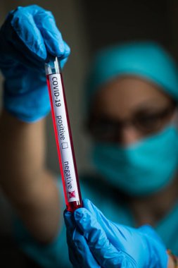 Coronavirus (COVID-19) için negatif örnekler içeren bir test tüpünü tutan ve gören bir doktorun kavramsal fotoğrafı).