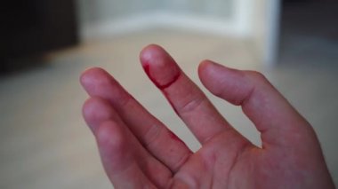 Erkek parmağı kanla kaplı.