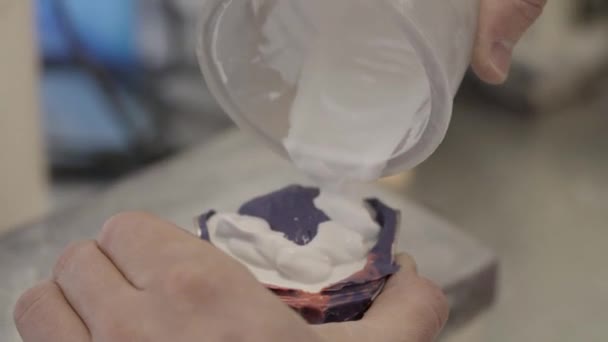 牙科技师为牙齿模具准备混合物 在牙科实验室制作人造青少年 牙科铸件中的专业孔隙聚合物材料 — 图库视频影像