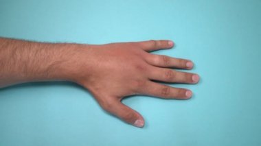 Erkek eli arı ya da arı tarafından sokulmuş. El şişmesi, iltihap, kızarıklık enfeksiyon belirtileri vardır. Sol elde böcek ısırığı