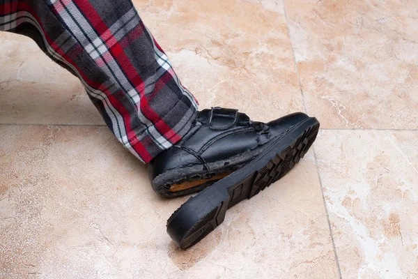 Kid Wearing Badly Broken Leather Shoe — Stock Photo, Image