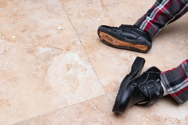 Kid Wearing Pair Badly Broken Leather Shoes — Stock Photo, Image