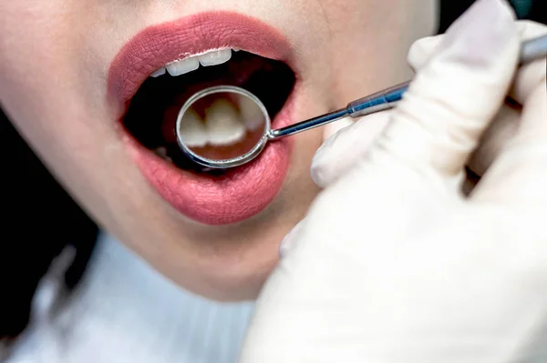 Patient open mouth during oral checkup by dentist.