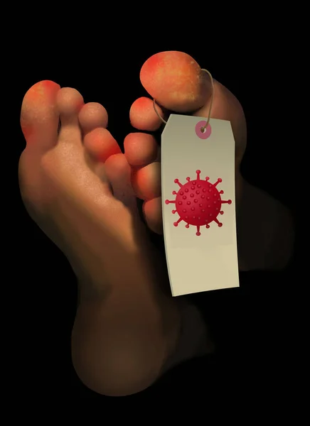 Covid Toes Ένα Κόκκινο Εξάνθημα Στα Δάχτυλα Των Ποδιών Των — Φωτογραφία Αρχείου
