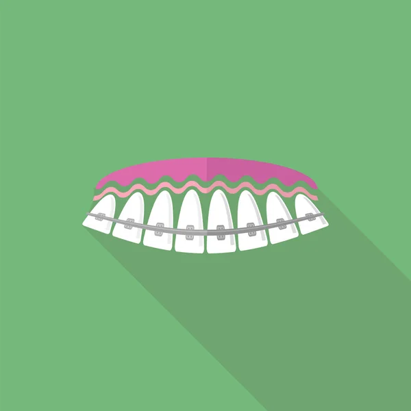 Medyczne szelki zęby. Pielęgnacja zębów tło. Leczenie ortodontyczne. — Zdjęcie stockowe