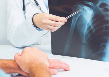Female doctors hand pointing at x-ray medical imaging at a shoulder condition clipart