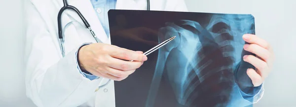 Kadın doktorlar, omuz rahatsızlığı olan röntgen filmlerini işaret ediyorlar. Kemik sağlığı, etki. Ortopedi ilacı. Sağlık ve ilaç servisi. Sakatlık. SLAP lezyonu. Tıbbi Sancak