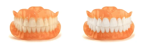 Dentaduras Totais Close Odontologia Ortopédica Com Uso Tecnologias Modernas Para — Fotografia de Stock