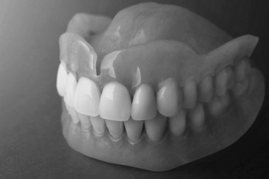 takma dişler. Beyaz arka plan akrilik protezler insan jaws üzerinde yalıtmak. Ortopedik diş hekimliği kavramı