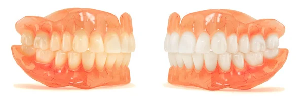 Zubní Protézy Izolujte Bílém Pozadí Akrylové Protézy Lidských Čelistí Koncept — Stock fotografie