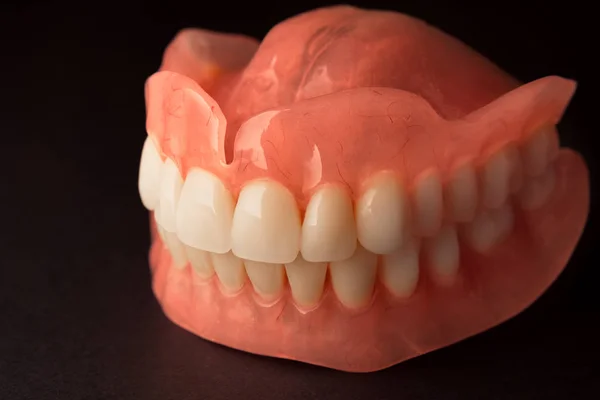 Dentaduras Isolar Fundo Branco Prótese Acrílica Mandíbulas Humanas Conceito Odontologia — Fotografia de Stock