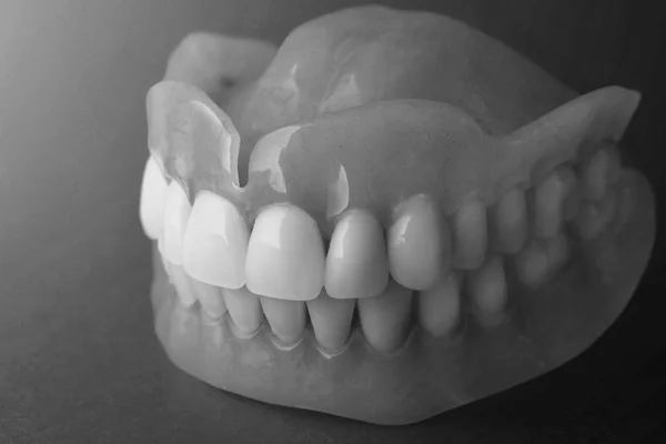 Dentaduras Isolar Fundo Branco Prótese Acrílica Mandíbulas Humanas Conceito Odontologia — Fotografia de Stock