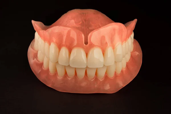 Full Denture Dentures Close Orthopedic Dentistry Use Modern Technologies Restore — Stock Photo, Image