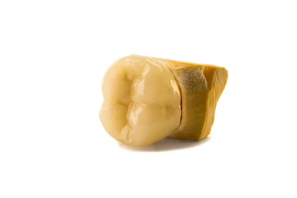 Coroa Dente Modelo Gesso Mandíbula Humana Macro Close Processo Fabricação — Fotografia de Stock