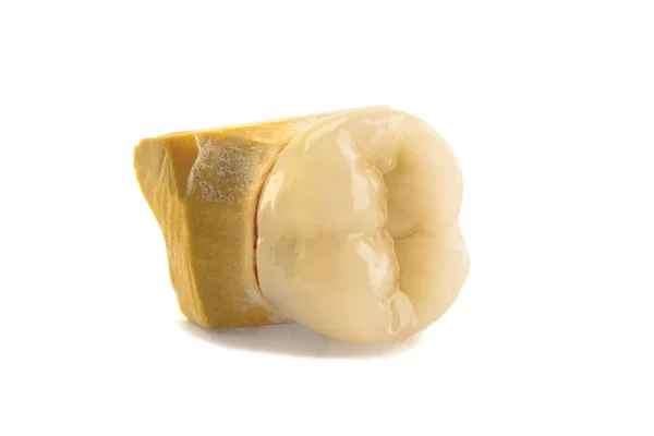 Seramik Seramik Taç Bir Diş Porselen Taç Yapma Protez Diş — Stok fotoğraf