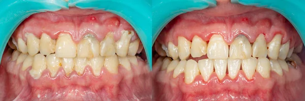 Targa Del Paziente Pietra Trattamento Odontoiatrico Della Placca Dentale Igiene — Foto Stock