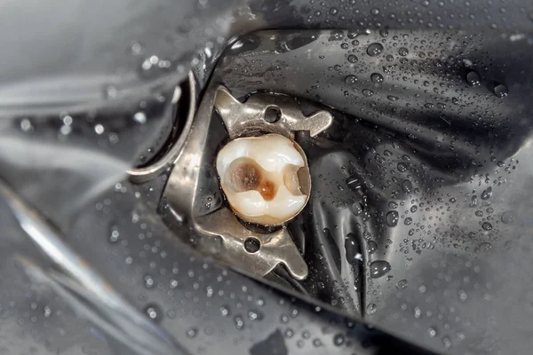 Cárie Dentária Enchimento Com Material Fotopolímero Composto Dental Usando Coelhos — Fotografia de Stock