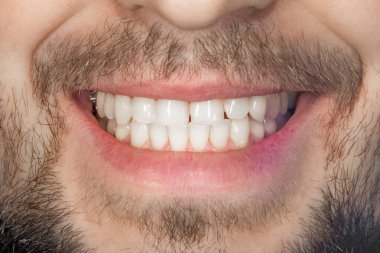 Diş gülümseme kapatın. Sağlıklı uygun ağız hijyeni kavramı