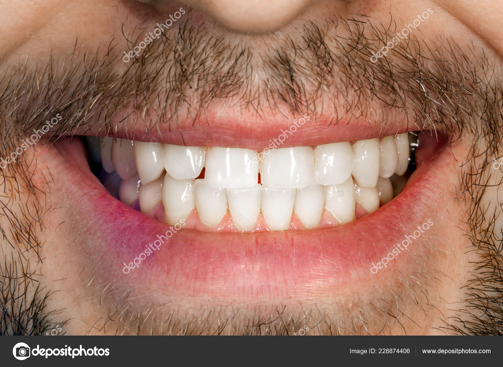 White Smile Teeth Man Close Concept Health Oral Stock Photo by ©schigirin91@gmail.com 228874406
