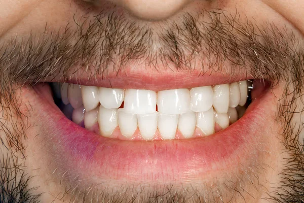 white smile, teeth of a man with a beard close-up. The concept of good health and oral hygiene